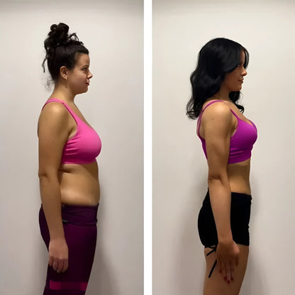 Slima™ Patchs Amincissants