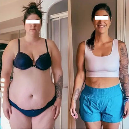 Slima™ Patchs Amincissants